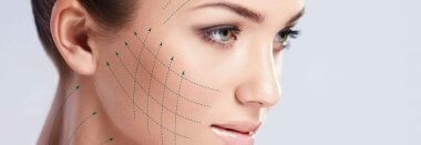 Чего ожидать от нитевого армирования кожи лица?