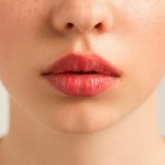 Увеличение губ — роскошь или необходимость миниатюра