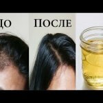 Как остановить выпадение волос народными средствами миниатюра