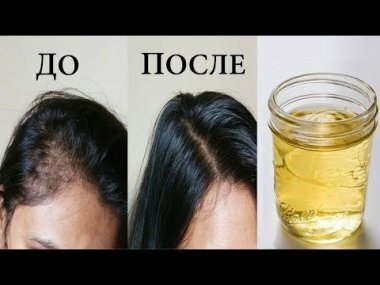 Как остановить выпадение волос народными средствами