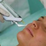 Лазерная эпиляция лица – процедура, которая доступна для каждой миниатюра