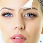 Морщины под глазами: причины появления и методы устранения